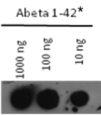 Abeta (1-42) | Amyloid-beta peptide 1-42 in the group Antibodies Human Cell Biology / Neuroscience / Neurodegenerative diseases / Alzheimer's disease at Agrisera AB (Antibodies for research) (AS08 328)